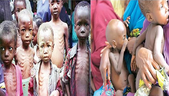 UNICEF Warns of Severe Malnutrition in Northwest Nigeria