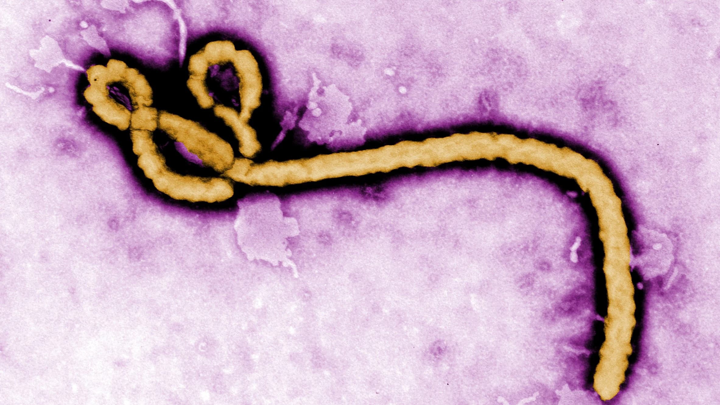 France Ebola Case from Congo
